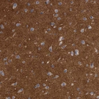 Immunohistochemical staining of human cerebral cortex shows strong positivity in neuropil.