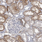 Immunohistochemical staining of human kidney shows weak to moderate cytoplasmic positivity in cells in tubules.