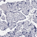 Immunohistochemical staining of human placenta shows no positivity in trophoblastic cells as expected.