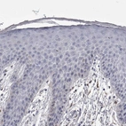 Immunohistochemical staining of human skin shows no positivity in squamous epithelial cells as expected.