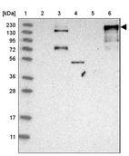 Lane 1: Marker [kDa] 230, 130, 95, 72, 56, 36, 28, 17, 11_br/_Lane 2: Human cell line RT-4_br/_Lane 3: Human cell line U-251MG sp_br/_Lane 4: Human plasma (IgG/HSA depleted)_br/_Lane 5: Human liver tissue_br/_Lane 6: Human tonsil tissue