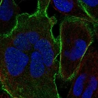Immunofluorescent staining of human cell line RH-30 shows localization to plasma membrane.