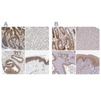 Anti-GPD2 Antibody