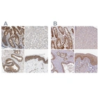 Immunohistochemical staining of human gastrointestinal, liver, prostate and squamous epithelia using Anti-GPD2 antibody HPA008012 (A) shows similar protein distribution across tissues to independent antibody HPA045506 (B).