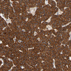Immunohistochemical staining of human parathyroid gland shows strong cytoplasmic granular positivity in glandular cells.