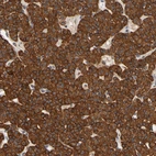 Immunohistochemical staining of human parathyroid gland shows strong cytoplasmic granular positivity in glandular cells.