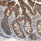 Immunohistochemical staining of human colon shows strong cytoplasmic granular positivity in glandular cells.