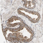 Immunohistochemical staining of human prostate shows strong cytoplasmic granular positivity in glandular cells.