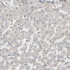 Anti-GPD2 Antibody