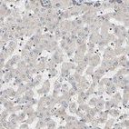 Immunohistochemical staining of human liver shows negative to very weak cytoplasmic granular positivity in hepatocytes.