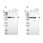 Western blot analysis using Anti-GPD2 antibody HPA008012 (A) shows similar pattern to independent antibody HPA045506 (B).