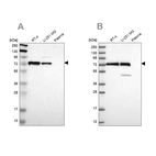 Western blot analysis using Anti-GPD2 antibody HPA008012 (A) shows similar pattern to independent antibody HPA045506 (B).