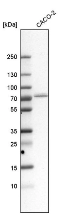 Western blot analysis in human cell line CACO-2.