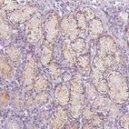 Immunohistochemical staining of human stomach shows strong cytoplasmic positivity in glandular cells.