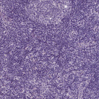 Anti-A4GNT Antibody