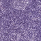 Immunohistochemical staining of human lymph node shows no positivity in non-germinal center cells as expected.