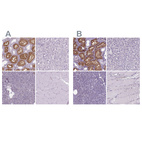 Immunohistochemical staining of human kidney, liver, pancreas and skeletal muscle using Anti-CLIC4 antibody HPA008019 (A) shows similar protein distribution across tissues to independent antibody HPA060804 (B).