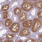 Immunohistochemical staining of human kidney shows strong membranous and cytoplasmic positivity in cells in tubules.
