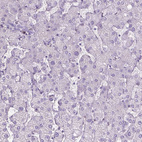 Immunohistochemical staining of human liver shows no positivity in hepatocytes as expected.