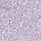 Immunohistochemical staining of human liver shows no positivity in hepatocytes as expected.