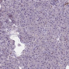Immunohistochemical staining of human pancreas shows no positivity in exocrine glandular cells as expected.