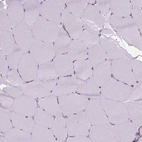Immunohistochemical staining of human skeletal muscle shows no positivity in myocytes as expected.