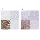 Immunohistochemical staining of human cerebral cortex, liver, pancreas and skeletal muscle using Anti-CEL antibody HPA008023 (A) shows similar protein distribution across tissues to independent antibody HPA052701 (B).