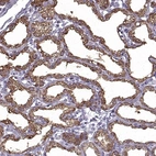 Immunohistochemical staining of human lactating breast shows moderate cytoplasmic positivity in glandular cells.