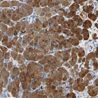 Immunohistochemical staining of human pancreas shows strong cytoplasmic positivity in exocrine glandular cells.