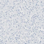 Immunohistochemical staining of human liver shows no positivity in hepatocytes as expected.