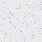 Immunohistochemical staining of human cerebral cortex shows no positivity in neurons as expected.