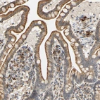 Anti-SFXN3 Antibody