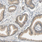 Immunohistochemical staining of human prostate shows moderate granular cytoplasmic positivity in glandular cells.