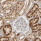 Immunohistochemical staining of human kidney shows strong granular cytoplamsc positivity in cells in tubules.