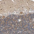 Immunohistochemical staining of human cerebellum shows moderate granular cytoplasmic positivity in Purkinje cells and cells in granular layer.
