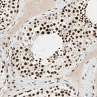 Anti-CDK12 Antibody