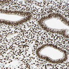Immunohistochemical staining of human endometrium shows strong nuclear positivity in glandular and stromal cells.