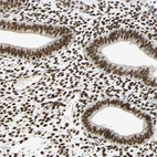 Immunohistochemical staining of human endometrium shows strong nuclear positivity in glandular and stromal cells.