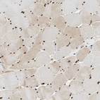 Immunohistochemical staining of human skeletal muscle shows strong nuclear positivity in myocytes.