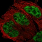 Immunofluorescent staining of human cell line A-431 shows localization to nucleoplasm.