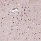 Immunohistochemical staining of human cerebral cortex shows moderate cytoplasmic positivity in neurons.