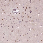 Immunohistochemical staining of human cerebral cortex shows moderate cytoplasmic positivity in neurons.