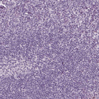 Immunohistochemical staining of human tonsil shows no positivity in non-germinal center cells as expected.