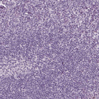 Anti-SLC6A17 Antibody