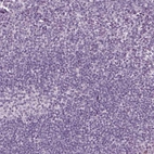 Immunohistochemical staining of human tonsil shows no positivity in non-germinal center cells as expected.