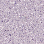 Anti-SLC6A17 Antibody