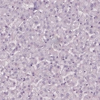 Immunohistochemical staining of human liver shows no positivity in hepatocytes as expected.