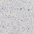 Immunohistochemical staining of human liver shows low expression as expected.