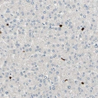 Immunohistochemical staining of human liver shows low expression as expected.