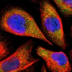 Immunofluorescent staining of human cell line A-431 shows localization to cytosol.